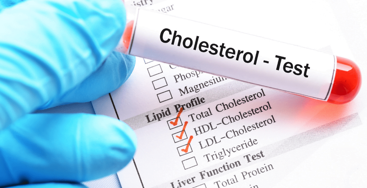 Blood Cholesterol Testing Service Imaan Healthcare